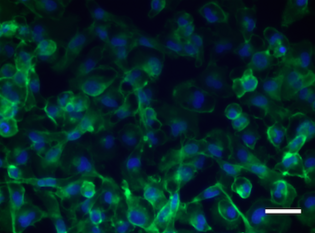 Fig. 3: Beta1 integrin expression in the human breast cancer cell line MDA-MB-231 stained in the Peyton Lab. Beta1 integrin (green) is expressed mainly around the periphery. DAPI stains the nuclei in blue. Scale bar is 50 microns.